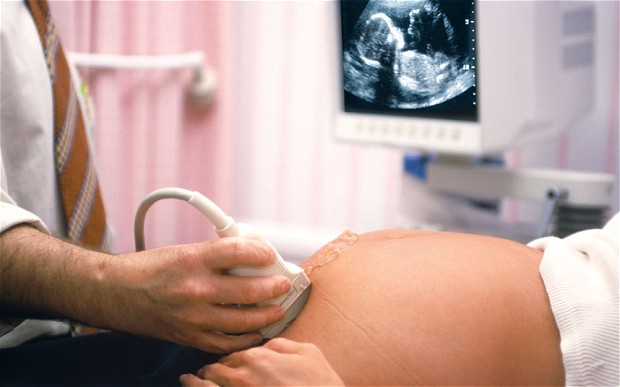 {:hr}Abortirana djeca spaljivana radi grijanja britanskih bolnica{:}